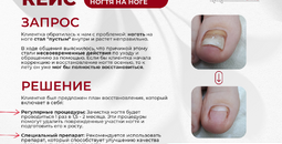 Реальные кейсы Центра подологии: как мы возвращаем здоровье и комфорт вашим стопам
